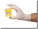 Urine Sample